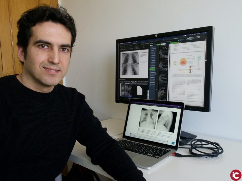 La Universidad de Alicante participa en un proyecto para detectar y localizar lesiones pulmonares por COVID-19 usando técnicas de inteligencia artificial