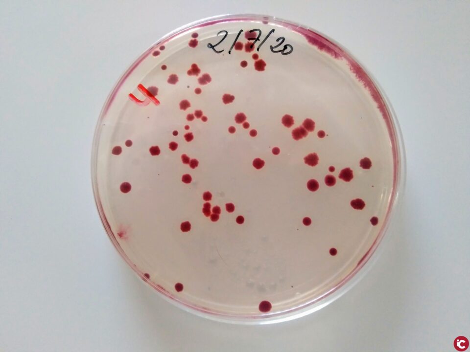 Aconsegueixen augmentar la vida útil de màscares
