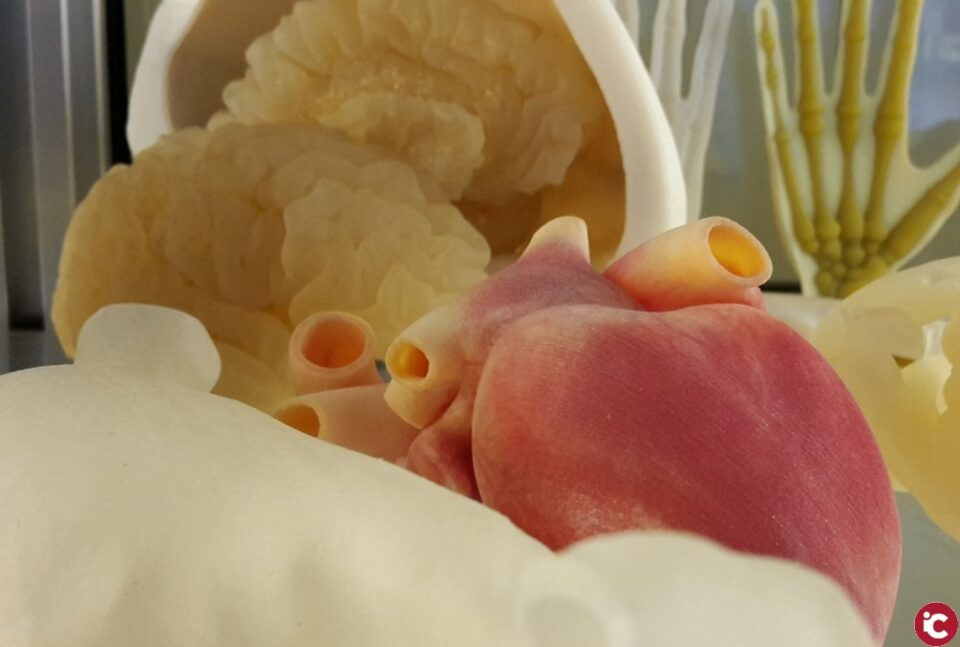 AIJU presenta un servicio de impresión 3D para replicar órganos y patologías concretas con precisión ultra realista pionero en Europa