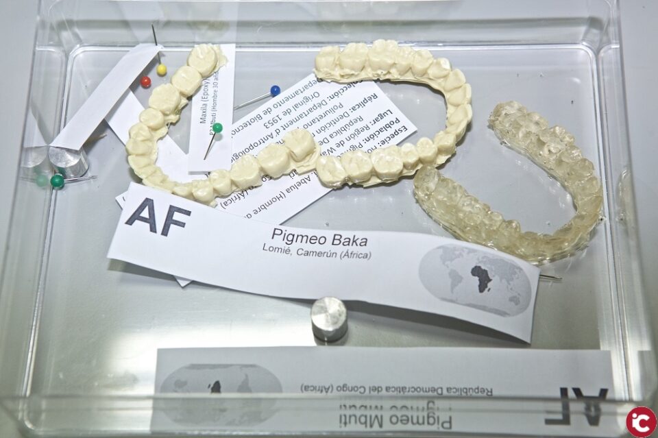 Descubren dientes grandes en pigmeos Baka frente a tribus de mayor estatura