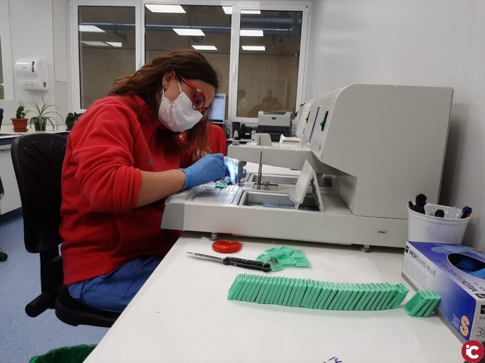 El nuevo laboratorio de Anatomía Patológica del Hospital de Elda realiza 22.000 determinaciones anuales