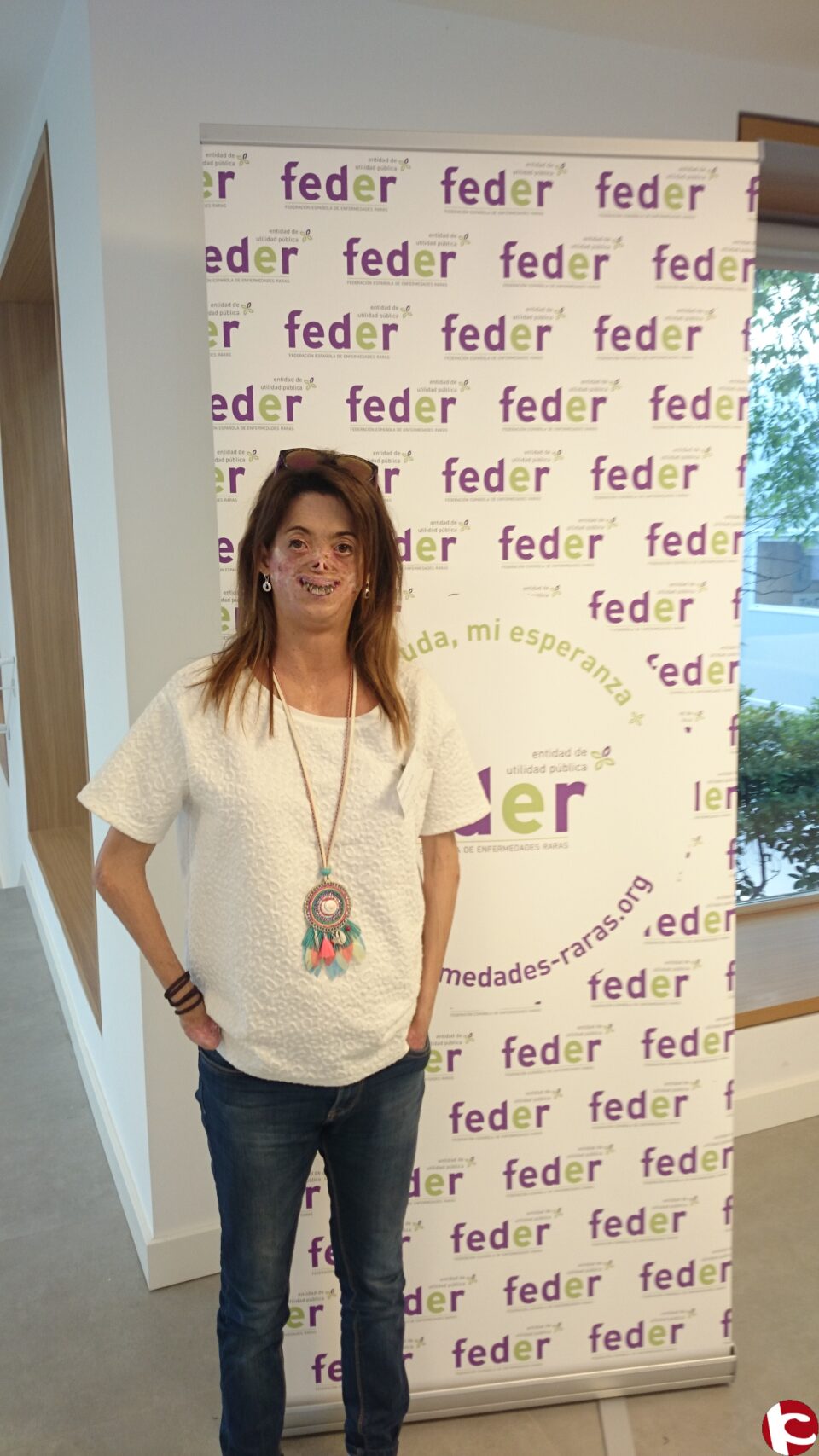 La Ibense Fide Mirón es nombrada Vicepresidenta de la Federación Española de Enfermedades Raras.